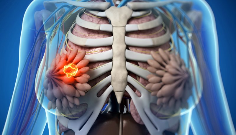 Detalhes Notícia