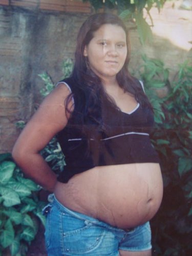 Jovem grávida morre após infarto e criança é salva