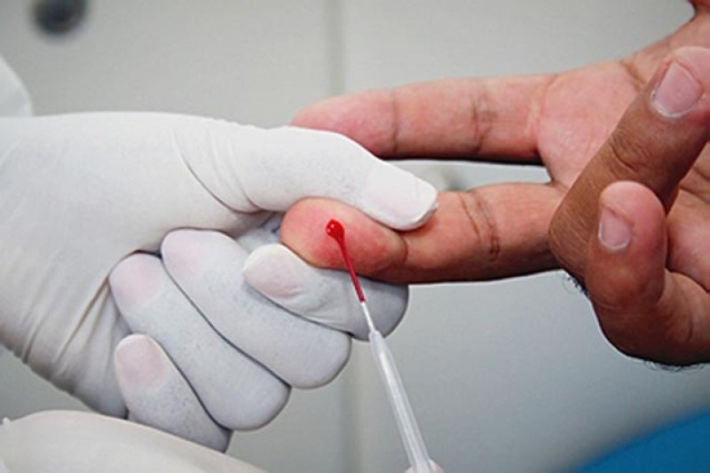 Testes de HIV podem ser feitos na UBS Cidade Jardim e Macro IV