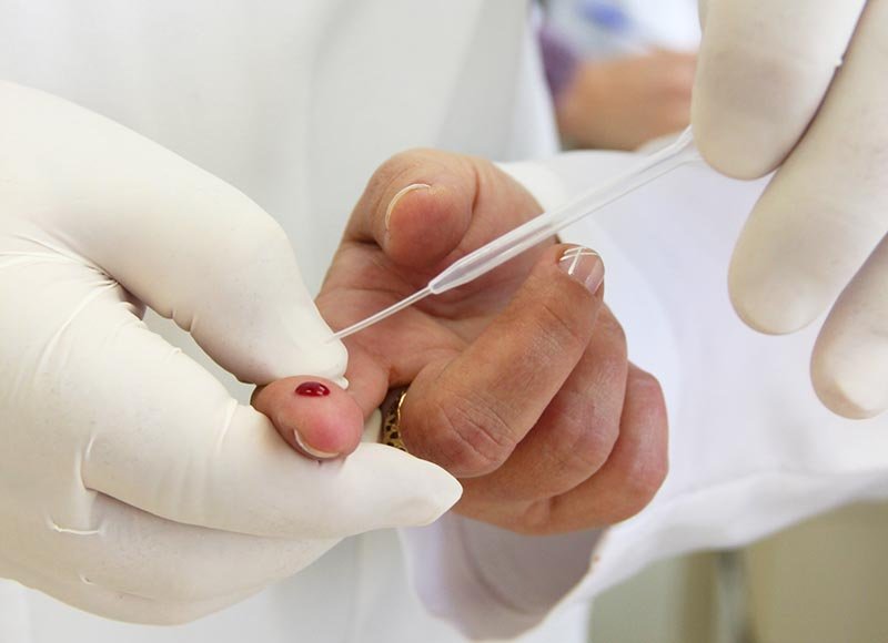 Dia Mundial de Luta Contra a Aids: Saúde alerta para prevenção e diagnóstico precoce