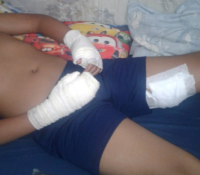 Menina de 12 anos é atacada pelo próprio Rottweiler