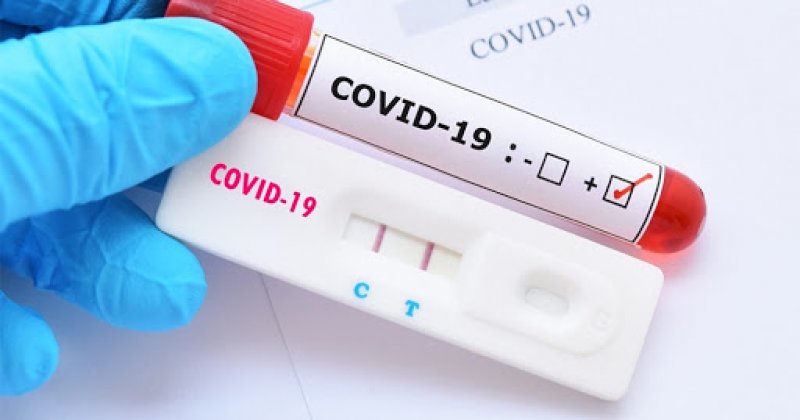Câmara defende ampliação de testes para Covid-19 em Penápolis