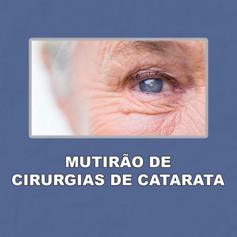 Câmara destaca viabilização de mutirão de cirurgias de catarata