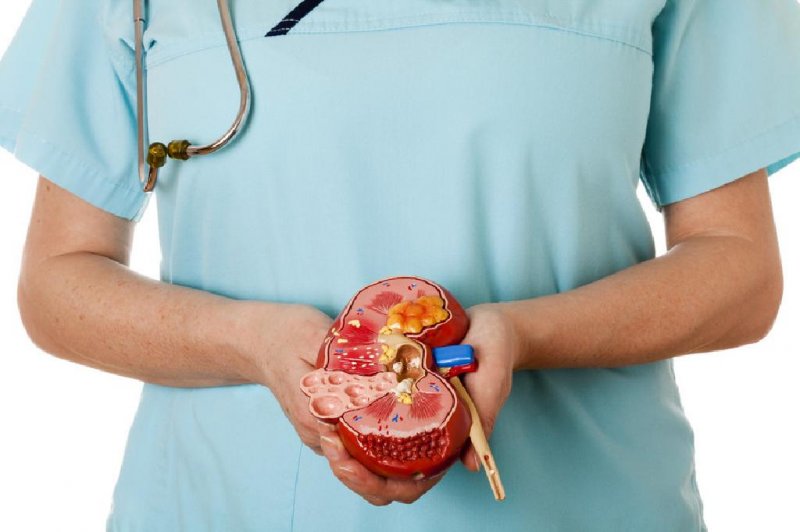 Requerimento busca informações sobre casos de cálculo renal