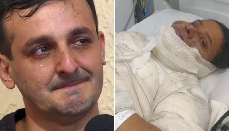 Marido lembra socorro à esposa vítima de acidente ao fritar ovo: 
