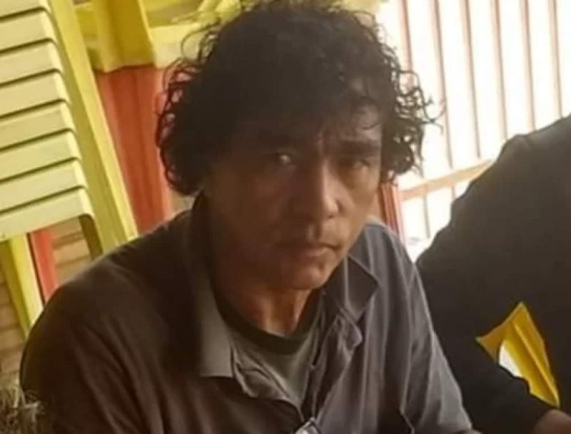 Vakinha virtual tenta arrecadar R$ 40 mil para motociclista que perdeu o nariz em colisão