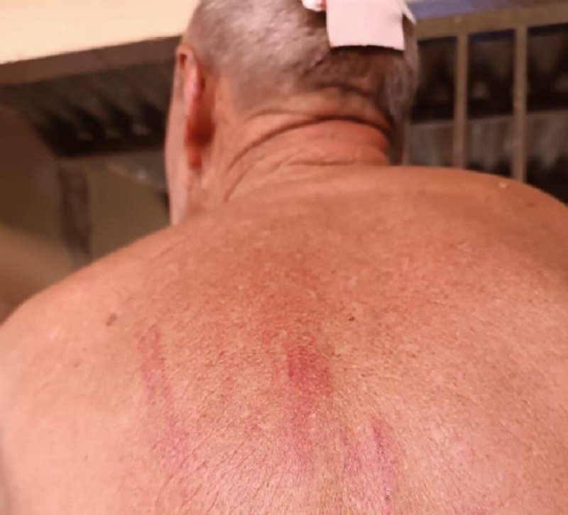 Idoso com Alzheimer é brutalmente atacado por três cães na região