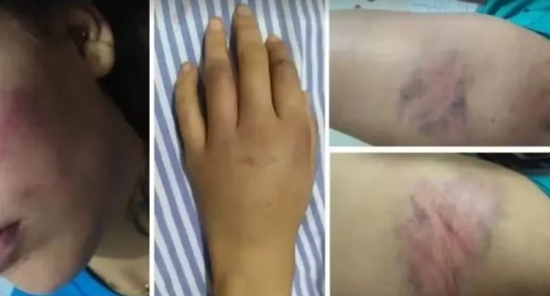 Homem é preso em Clementina suspeito de agredir a companheira, abandoná-la em pronto-socorro e tentar fugir