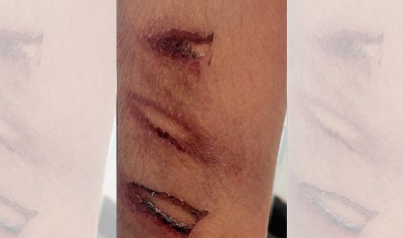Polícia Civil prende homem em flagrante por maus-tratos ao enteado de 10 anos