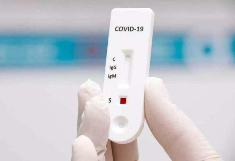 Farmacêuticos serão treinados para a realização de testes de Covid-19 nas farmácias
