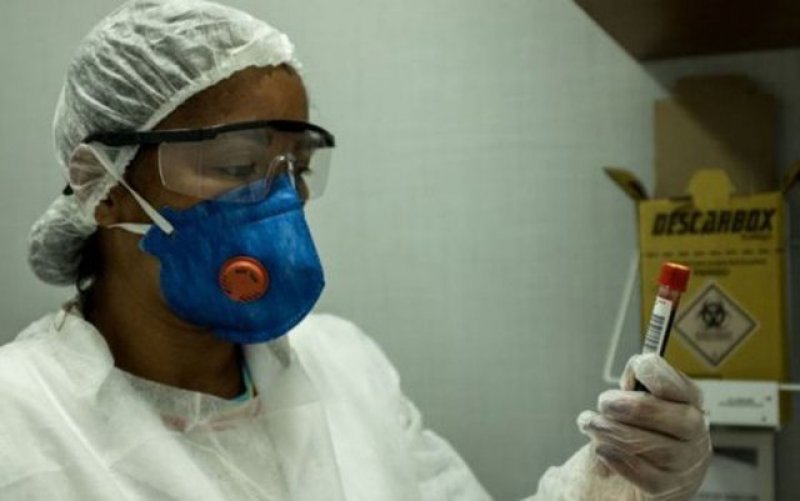 Covid-19: Brasil tem 428 mortes em 24h, chega a 6.329 e supera 90 mil casos